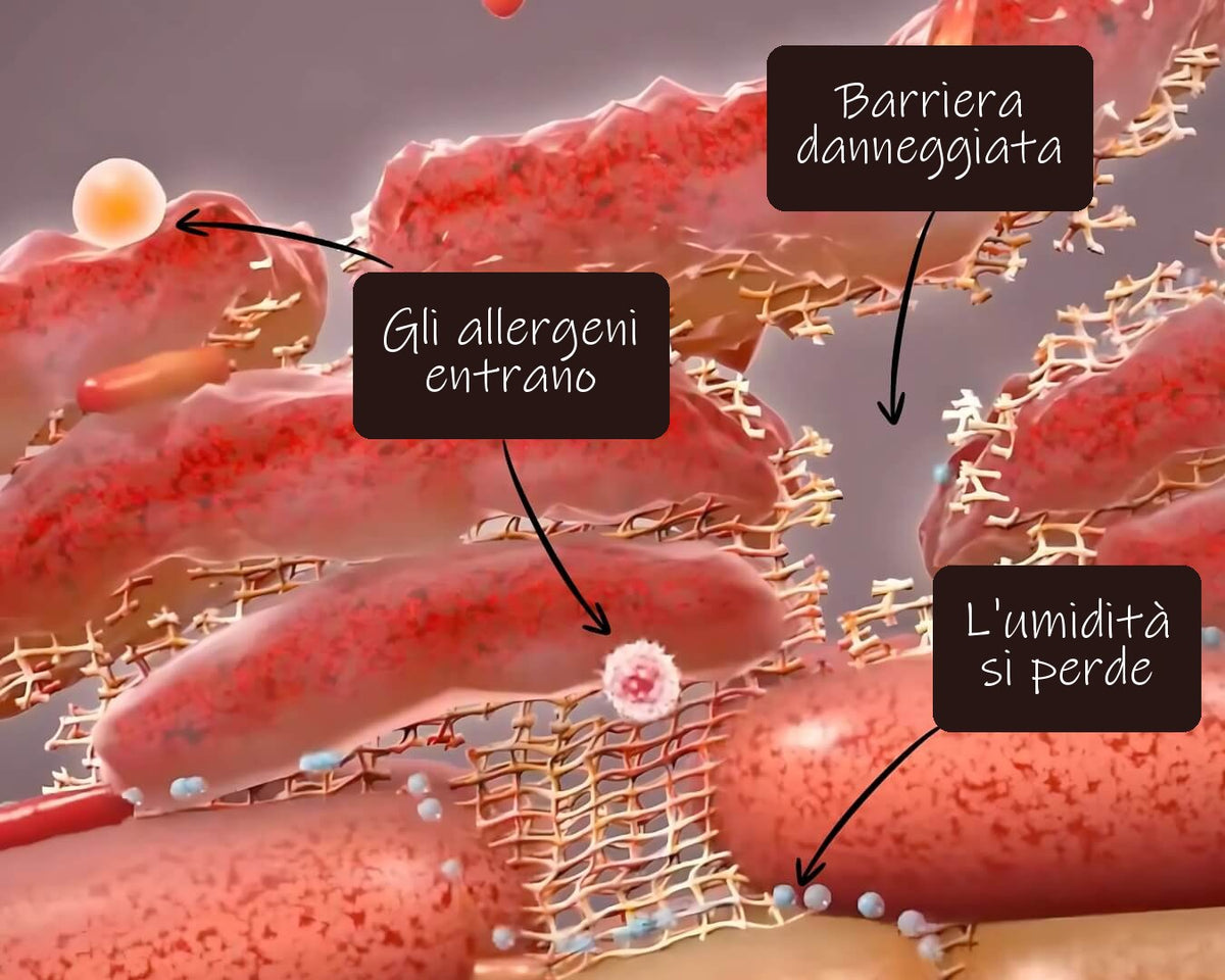 Barriera danneggiata: gli allergeni entrano e l'umidità si perde